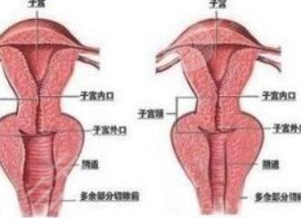 紧缩