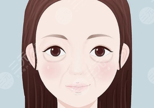 激光去眼袋能保持多久？多少钱？