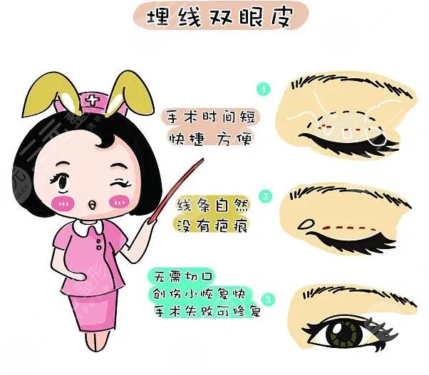 埋线双眼皮多少钱?