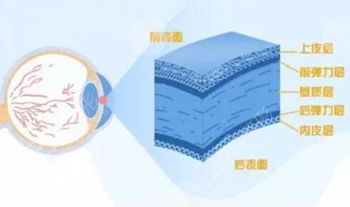 激光治疗近视眼的危害副作用有哪些?