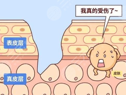 疤痕修复能恢复到什么程度？