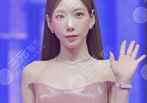 金泰妍整容脸部僵硬了？