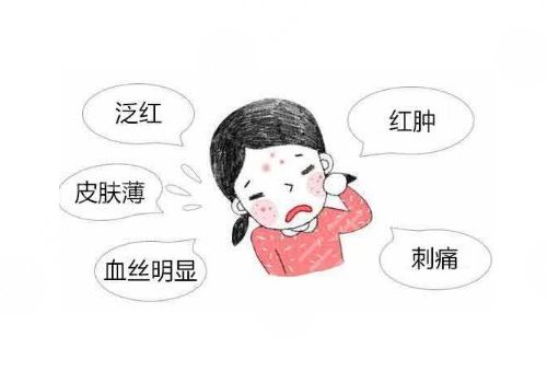 怎么减少红血丝的产生?