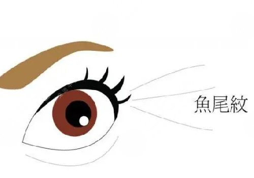 去除眼部细纹的方法有哪些？