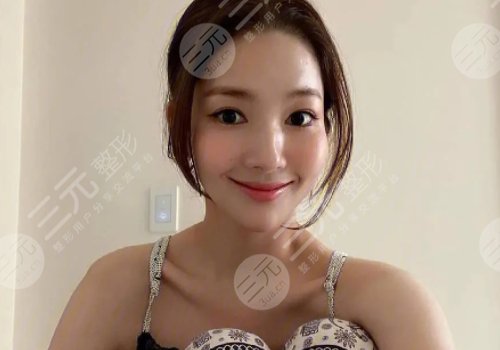 朴敏英整容脸部僵硬了吗？