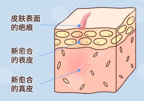 疤痕修复价格一般要多少钱？