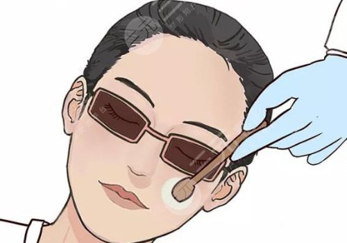热玛吉四代全脸做一次多少钱？