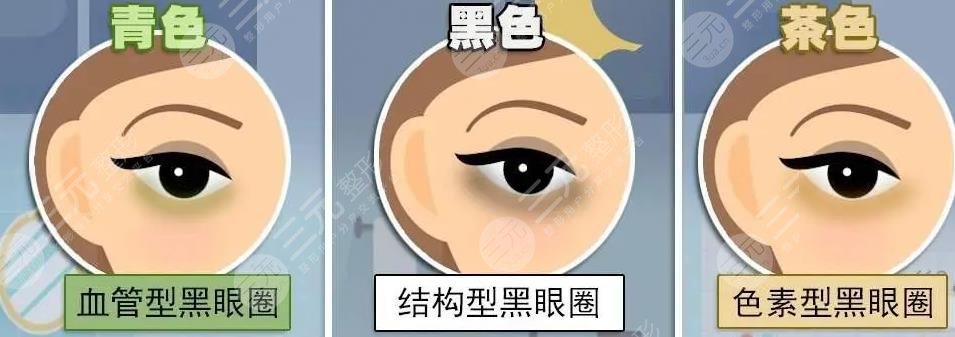 有了黑眼圈怎么消除？