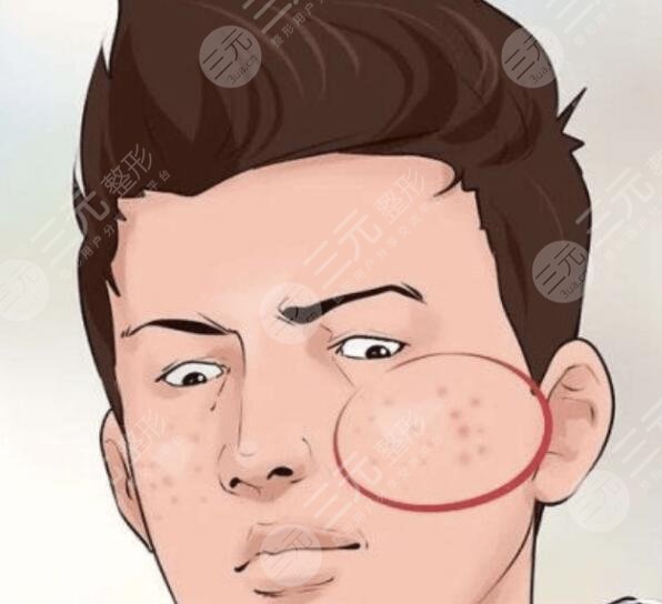清洁皮肤是关键