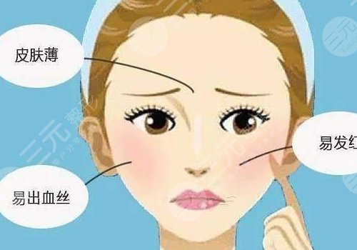 红血丝皮肤用什么护肤品？3
