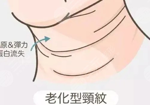 热玛吉面部颈部多少发？