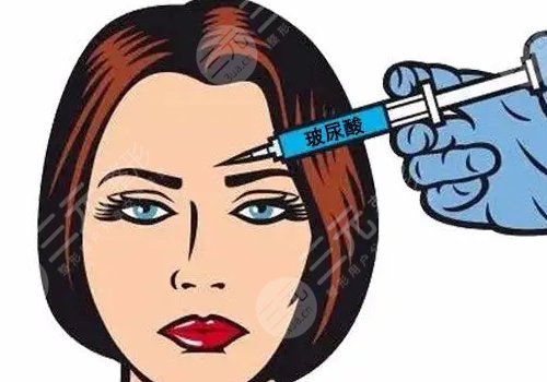面颊凹陷填充玻尿酸需要几支？会移位吗？