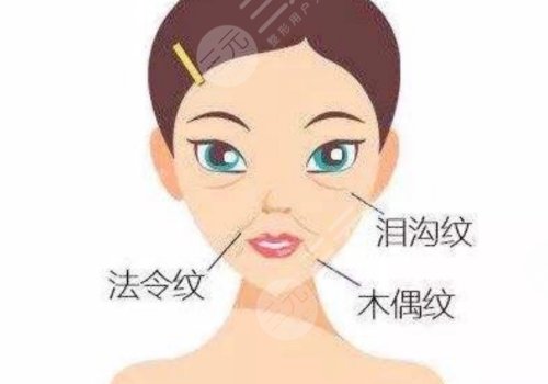 泪沟填充的危害有哪些?