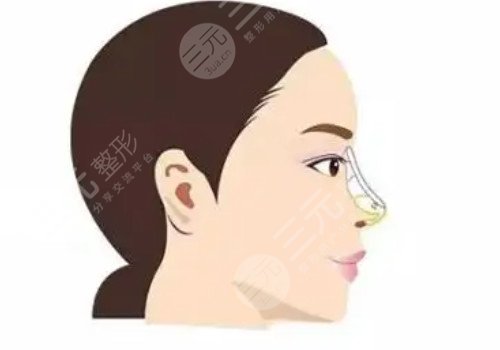 鼻梁山根低怎么办？
