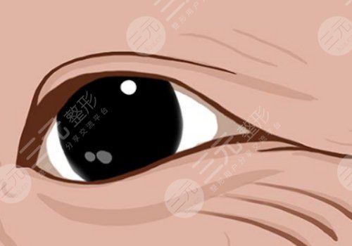 肤莱美和肤丽美的区别是什么？