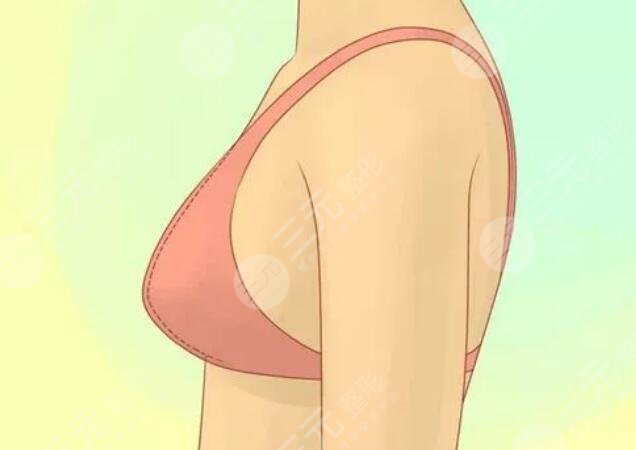 隆胸术后的10大注意事项你了解吗？隆胸专家现身说法！