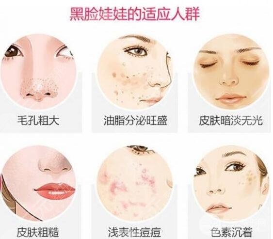 黑脸娃娃