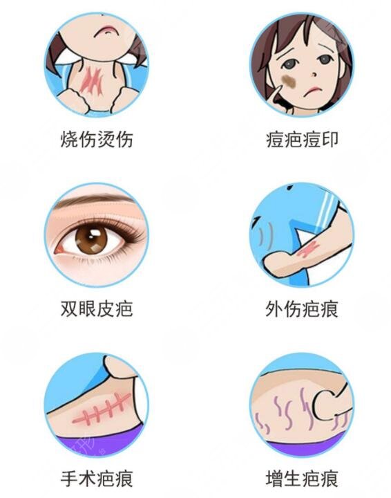 像素激光去疤术后注意事项