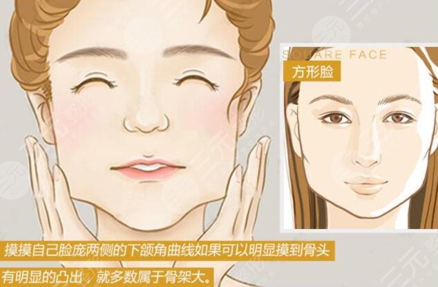 磨下颌骨瘦脸有后遗症吗怎么治疗？可能伴随的风险！