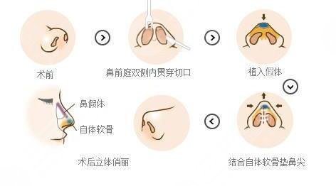 影响呼吸功能