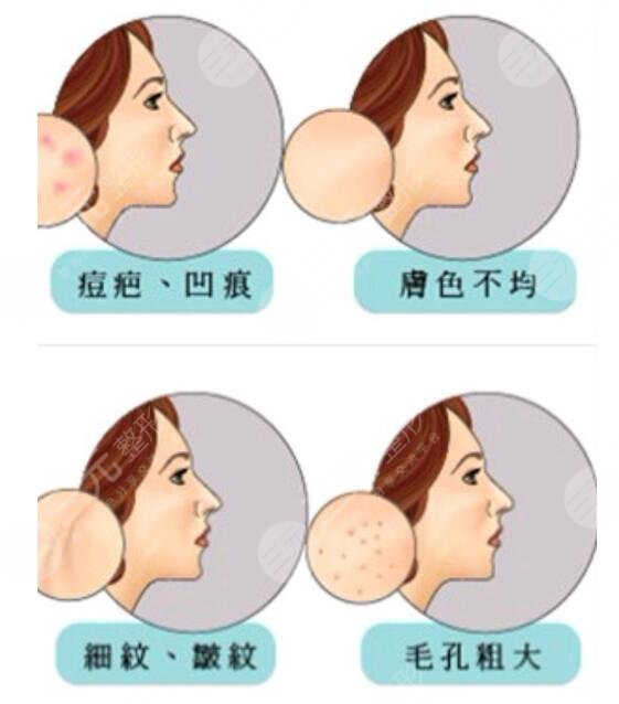 点阵像素激光的应用领域