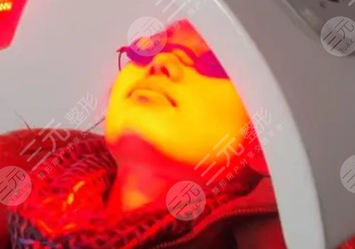 红光治疗痤疮能不能每天都照？