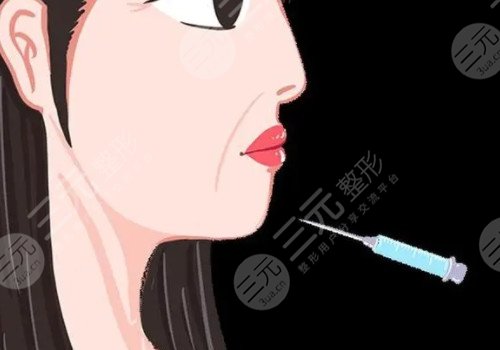 莫娜丽莎的玻尿酸可以填充哪里？