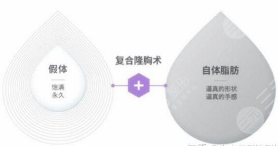 隆胸