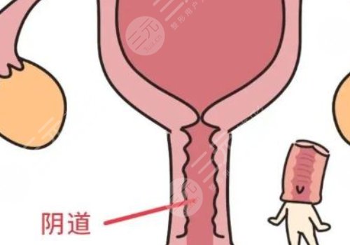 女性私处修复手术大概多少钱？