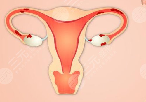 女性私处修复手术大概多少钱？