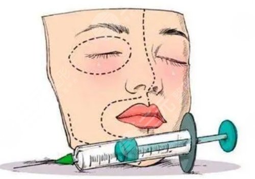 注射除皱费用多少？