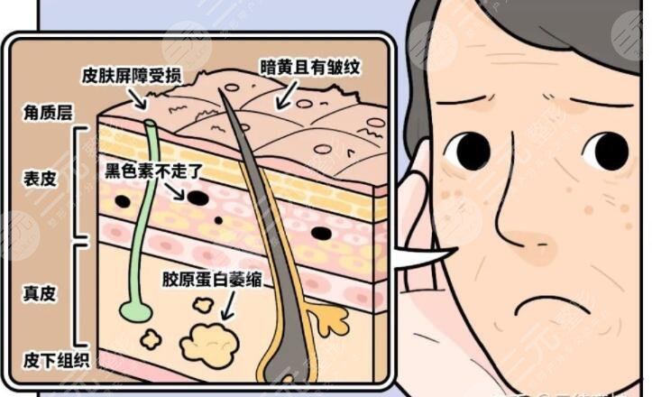 肤色不匀怎么办才能改善?