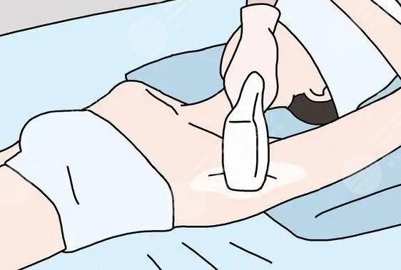 激光脱毛大概多少钱?