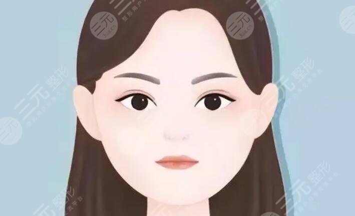 去颊脂垫