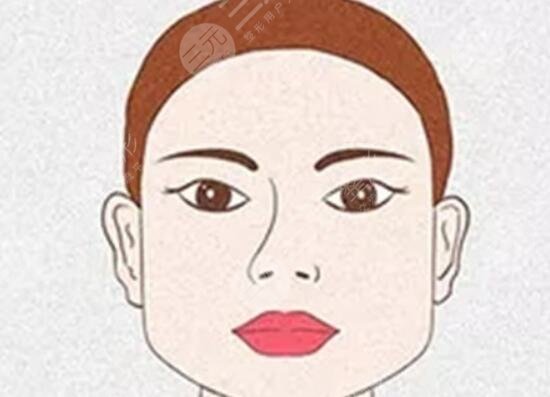 去颊脂垫
