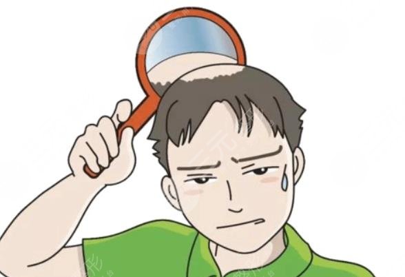 脱发