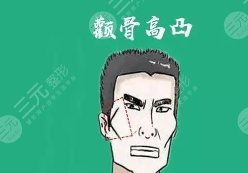 颧骨太突出怎么改善？
