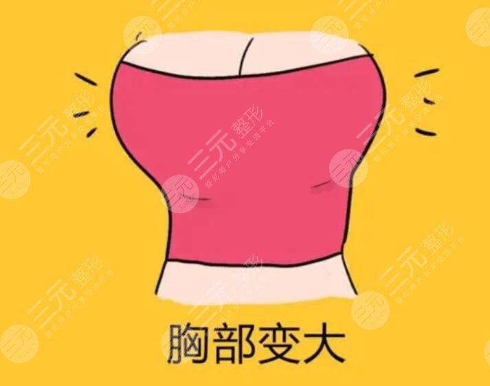 强生铂蕴隆胸假体怎么样？这种假体的优势是什么？呈现的效果怎么样？