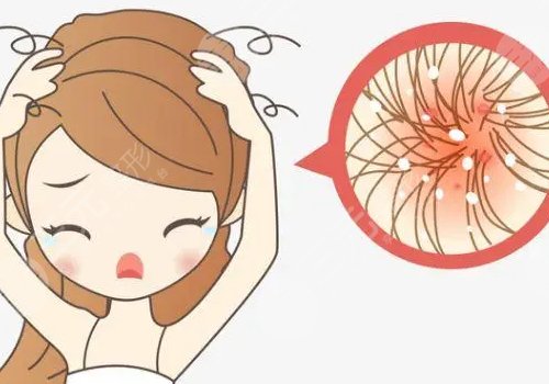 头发少怎么增加发量?