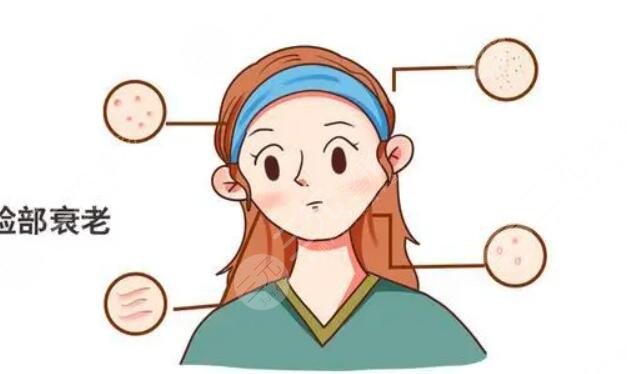 除皱