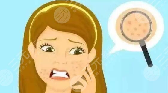 如何使面部毛孔变得细腻