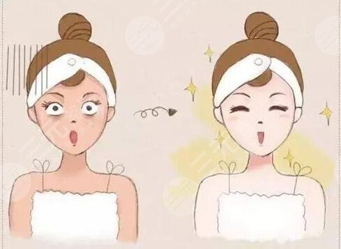 激光美白