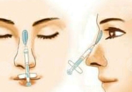 瑞蓝丽堤玻尿酸维持时间是多久？