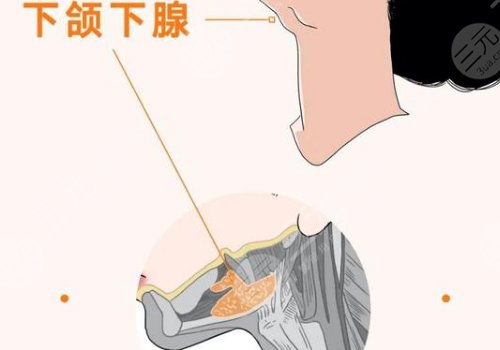 下颌缘轮廓注射多少钱？能维持多久？