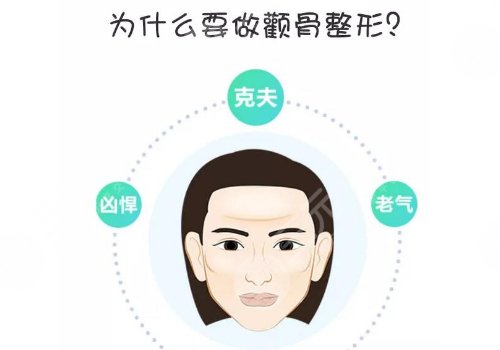 颧骨内推风险高吗？多少钱？