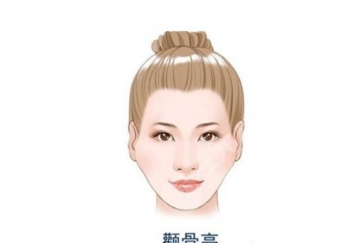 颧骨内推风险高吗？多少钱？