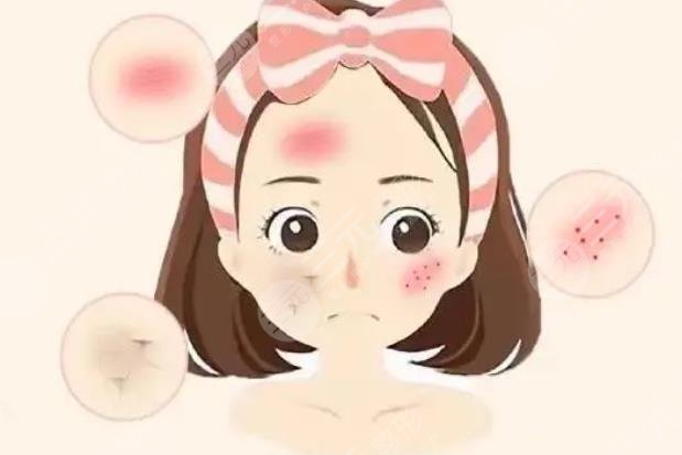 敏感肌