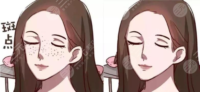 中药祛斑：自然、温和，安全无副作用