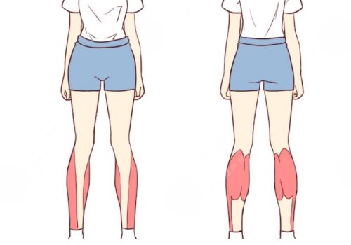 小腿吸脂后多久可以正常走路？