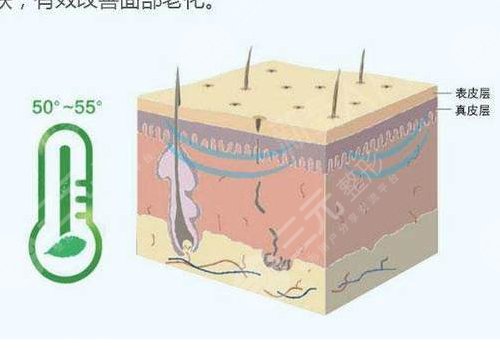 热拉提plus做一次可以维持多久？